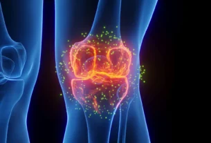 3d knee joint inflammation osteoarthritis